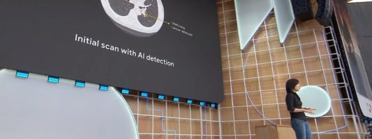 Google: Νέο σύστημα τεχνητής νοημοσύνης ανιχνεύει παθήσεις στους πνεύμονες