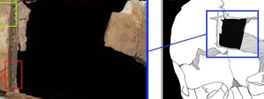 Άνθρωπος με τετράγωνη τρύπα στο κρανίο του – Ένδειξη για χειρουργική εγκεφάλου πριν 3.500 χρόνια στο Ισραήλ